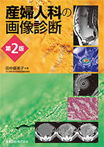 産婦人科の画像診断